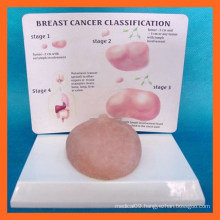 Human Breast Cancer Self-Exam Model